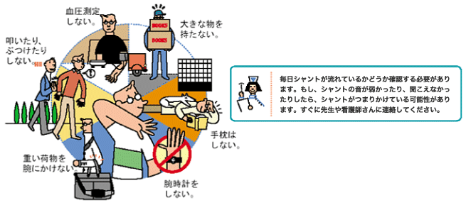 大きな物を持たない。/手枕はしない。/腕時計をしない。/重い荷物を腕にかけない。/叩いたり、ぶつけたりしない。/血圧測定しない。/毎日シャントが流れているかどうか確認する必要があります。もし、シャントの音が弱かったり、聞こえなかったりしたら、シャントがつまりかけている可能性があります。すぐに先生や看護師さんに連絡してください。